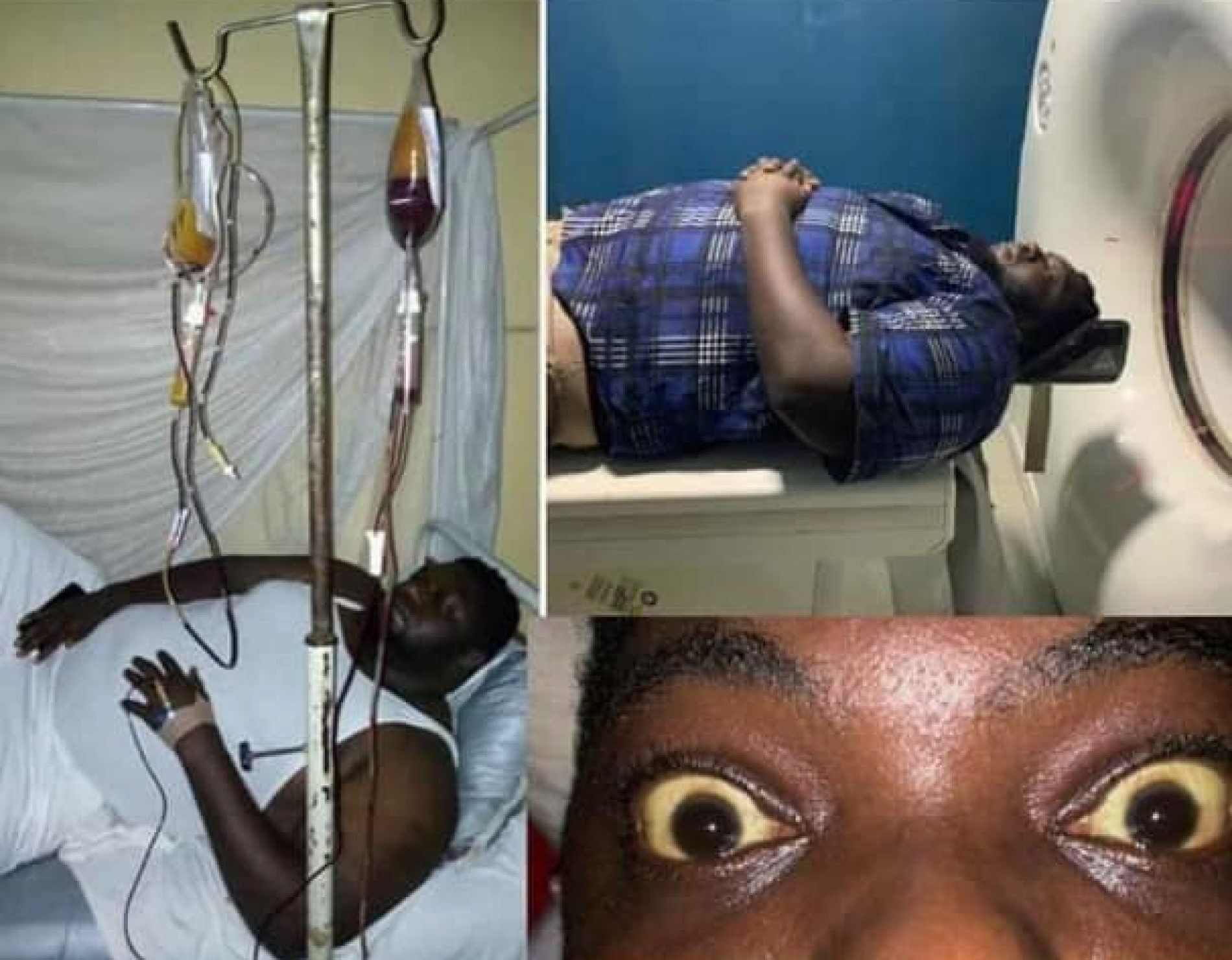 #10000ForPapi: 10,000 People Needed To Save Nnamdi Paulcy Iwuala