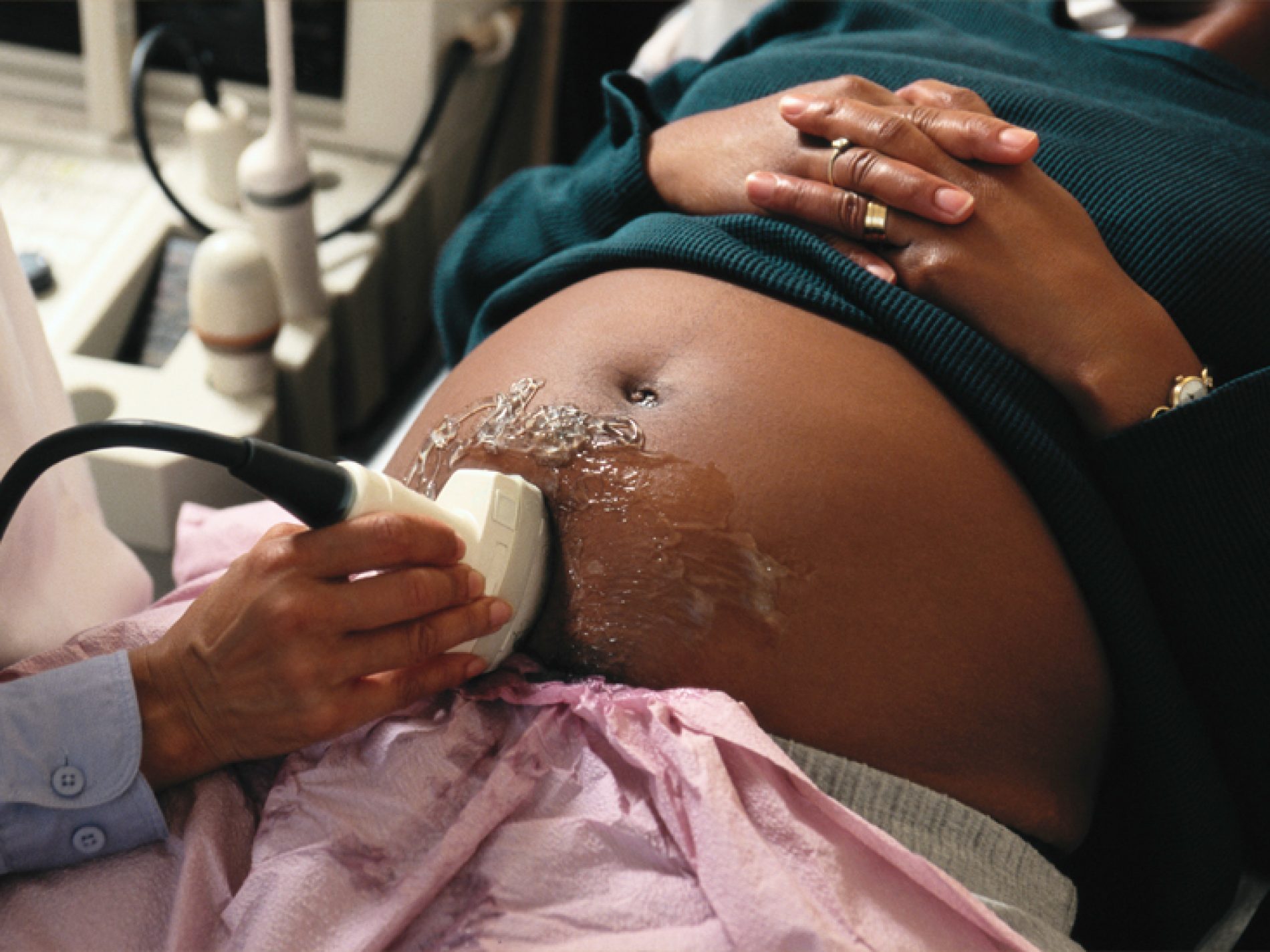 Biological Factors That Causes Miscarriage Revealed