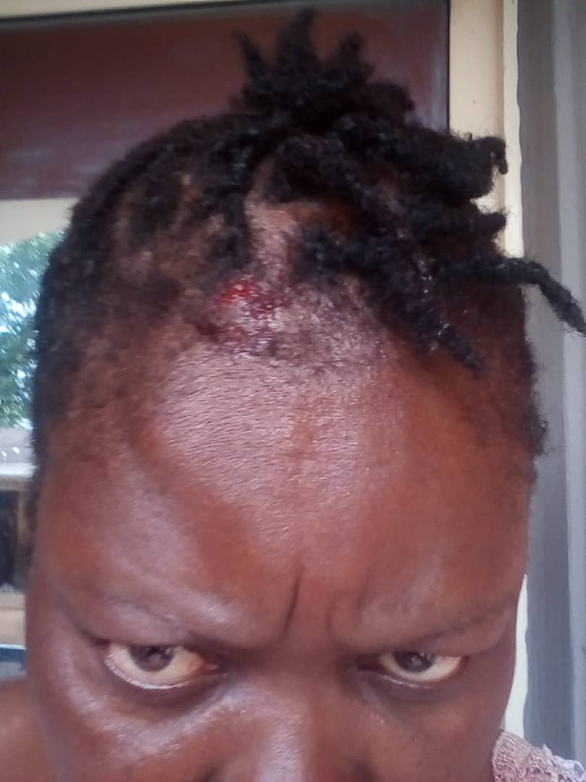 Revealed: How OCDA GM, Ikpeamezie, Wife Brutalized, Dehumanized Me- Chinyere Opara